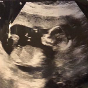 Meet your Posher, Juan